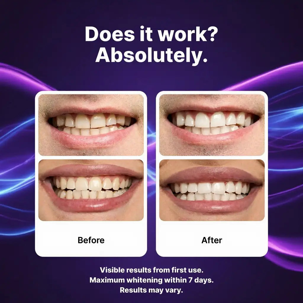 🦷 PAWSRICO ✨ Purple Tone-Correcting × Peroxide-Free Advanced Whitening Strips — 30-Minute At-Home Smile Brightening Routine (Gentle for Sensitive Teeth)