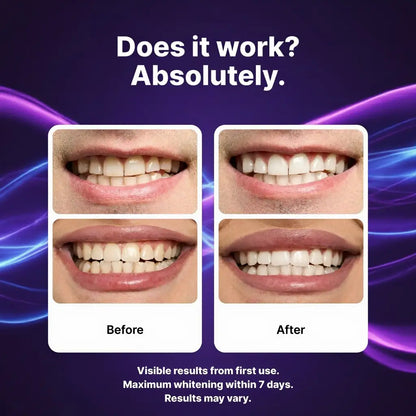 🦷 PAWSRICO ✨ Purple Tone-Correcting × Peroxide-Free Advanced Whitening Strips — 30-Minute At-Home Smile Brightening Routine (Gentle for Sensitive Teeth)